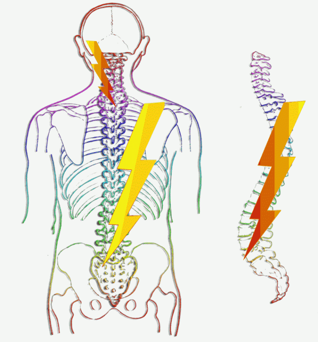 ako sa zbaviť bolesti, problémy bedernej - krčnej chrbtice.
